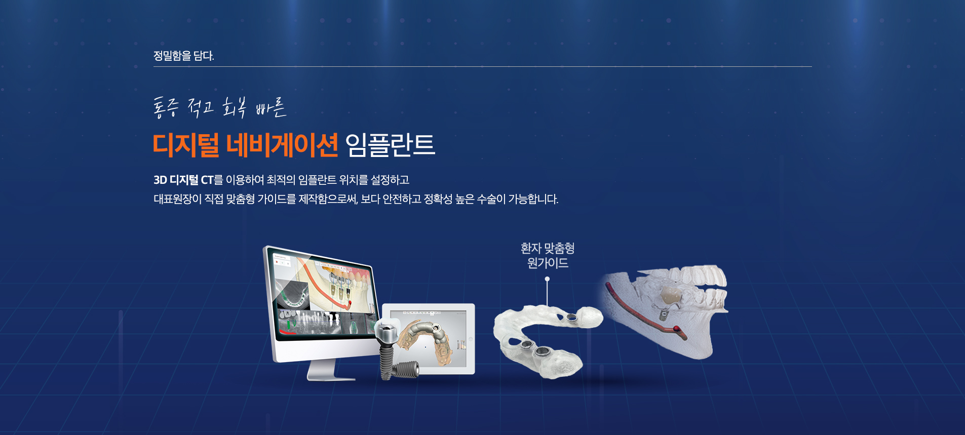 디지털 네이게이션 임플란트